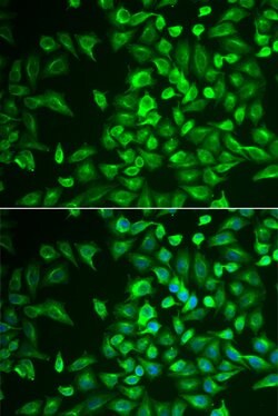 LRAT Polyclonal Antibody, Invitrogen 100 &mu;L; Unconjugated:Antibodies,