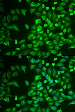 LRAT Polyclonal Antibody, Invitrogen 100 &mu;L; Unconjugated:Antibodies,