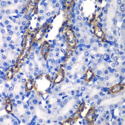 Invitrogen MATK Polyclonal Antibody 100 &mu;L; Unconjugated:Anticuerpos