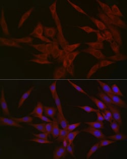 Invitrogen NPHP1 Polyclonal Antibody 100 &mu;L; Unconjugated:Antibodies,