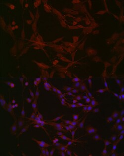 Invitrogen NPHP1 Polyclonal Antibody 100 &mu;L; Unconjugated:Antibodies,