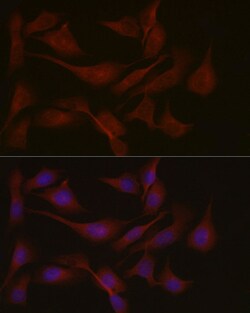 Invitrogen NPHP1 Polyclonal Antibody 100 &mu;L; Unconjugated:Antibodies,