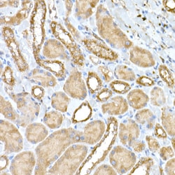 Invitrogen NPHP1 Polyclonal Antibody 100 &mu;L; Unconjugated:Antibodies,