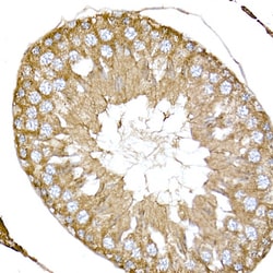 Invitrogen NPHP1 Polyclonal Antibody 100 &mu;L; Unconjugated:Antibodies,