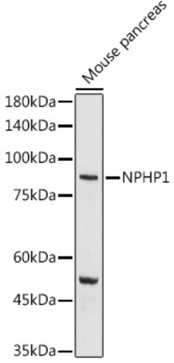 Invitrogen NPHP1 Polyclonal Antibody 100 &mu;L; Unconjugated:Antibodies,