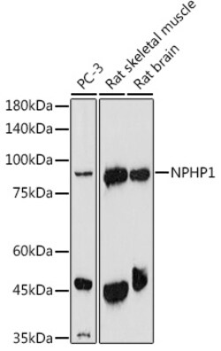 Invitrogen NPHP1 Polyclonal Antibody 100 &mu;L; Unconjugated:Antibodies,