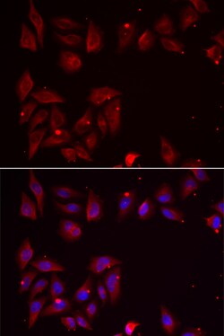 Invitrogen PDXK Polyclonal Antibody 100 μL; Unconjugated:Antibodies,
