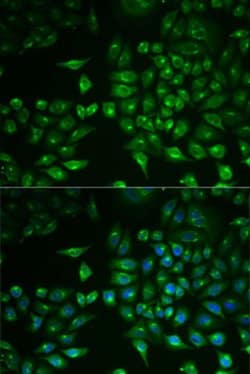 PLA2G2D Polyclonal Antibody, Invitrogen 100 &mu;L; Unconjugated:Antibodies,