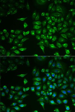 PLA2G2D Polyclonal Antibody, Invitrogen 100 &mu;L; Unconjugated:Antibodies,