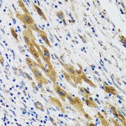 PLA2G2D Polyclonal Antibody, Invitrogen 100 &mu;L; Unconjugated:Antibodies,