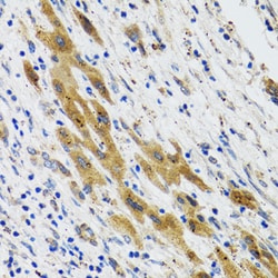 PLA2G2D Polyclonal Antibody, Invitrogen 100 &mu;L; Unconjugated:Antibodies,