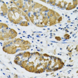 PLA2G2D Polyclonal Antibody, Invitrogen 100 &mu;L; Unconjugated:Antibodies,
