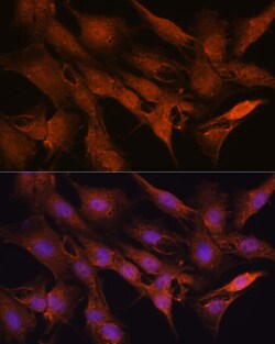 Invitrogen PPM1A Polyclonal Antibody 100 &mu;L; Unconjugated:Antibodies,