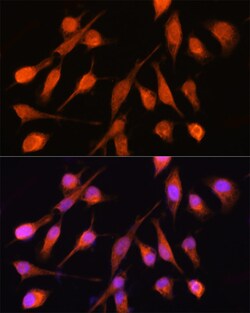 Invitrogen PPM1A Polyclonal Antibody 100 &mu;L; Unconjugated:Antibodies,