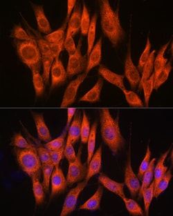 Invitrogen PPM1A Polyclonal Antibody 100 &mu;L; Unconjugated:Antibodies,
