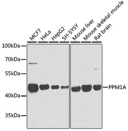 Invitrogen PPM1A Polyclonal Antibody 100 &mu;L; Unconjugated:Antibodies,
