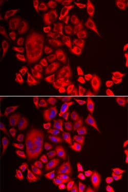 Invitrogen QPCT Polyclonal Antibody 100 &mu;L; Unconjugated:Antibodies,