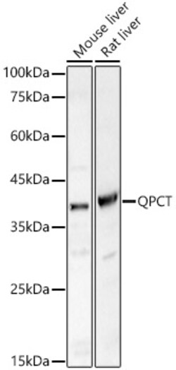 Invitrogen QPCT Polyclonal Antibody 100 &mu;L; Unconjugated:Antibodies,