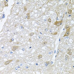 Invitrogen RAPSN Polyclonal Antibody 100 &mu;L; Unconjugated:Antibodies,