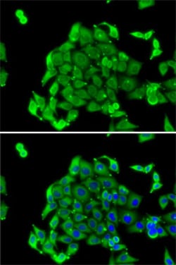 Invitrogen RPS14 Polyclonal Antibody 100 &mu;L; Unconjugated:Antibodies,