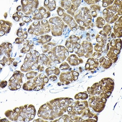 Invitrogen RPS14 Polyclonal Antibody 100 &mu;L; Unconjugated:Antibodies,
