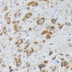 Invitrogen RPS14 Polyclonal Antibody 100 &mu;L; Unconjugated:Antibodies,