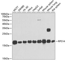 Invitrogen RPS14 Polyclonal Antibody 100 &mu;L; Unconjugated:Antibodies,