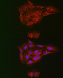 Invitrogen Rhotekin Polyclonal Antibody 100 &mu;L; Unconjugated:Antibodies,