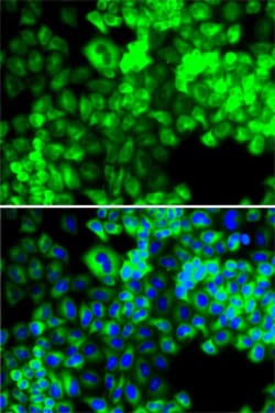 Invitrogen Seryl-tRNA synthetase Polyclonal Antibody 100 &mu;L; Unconjugated:Antibodies,
