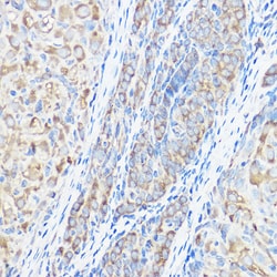 Invitrogen Seryl-tRNA synthetase Polyclonal Antibody 100 &mu;L; Unconjugated:Antibodies,