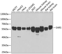 Invitrogen Seryl-tRNA synthetase Polyclonal Antibody 100 &mu;L; Unconjugated:Antibodies,