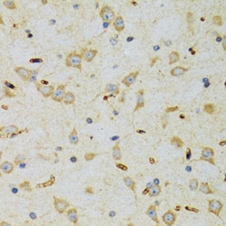 Invitrogen SRP19 Polyclonal Antibody 100 &mu;L; Unconjugated:Antibodies,