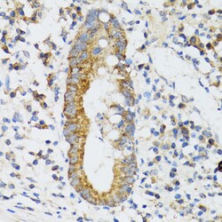 Invitrogen SRP19 Polyclonal Antibody 100 &mu;L; Unconjugated:Antibodies,
