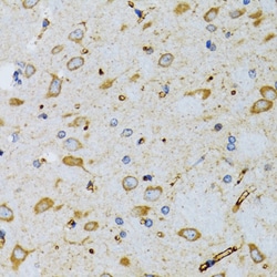 Invitrogen SRP19 Polyclonal Antibody 100 &mu;L; Unconjugated:Antibodies,