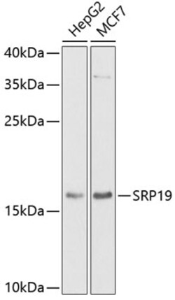 Invitrogen SRP19 Polyclonal Antibody 100 &mu;L; Unconjugated:Antibodies,