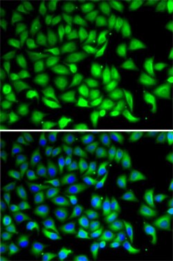 Invitrogen SUFU Polyclonal Antibody 100 &mu;L; Unconjugated:Antibodies,