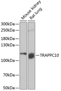 Invitrogen TRAPPC10 Polyclonal Antibody 100 &mu;L; Unconjugated:Antibodies,
