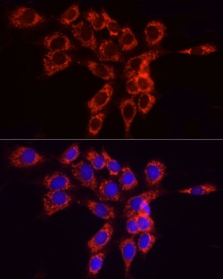 Invitrogen ACSL4 Polyclonal Antibody 100 &mu;L; Unconjugated:Antibodies,
