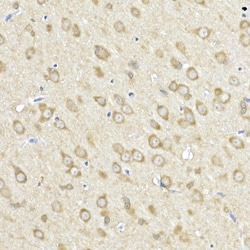 Invitrogen ACSL4 Polyclonal Antibody 100 &mu;L; Unconjugated:Antibodies,