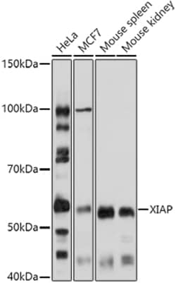 XIAP Polyclonal Antibody:Antibodies, Polyclonal