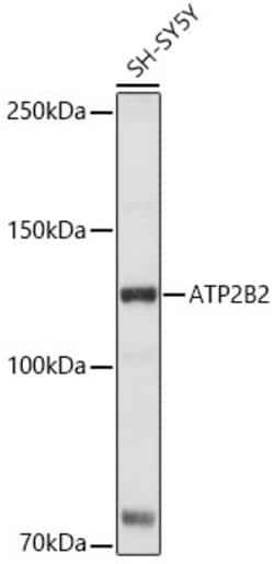 Invitrogen PMCA2 ATPase Polyclonal Antibody 100 &mu;L; Unconjugated:Antikroppar