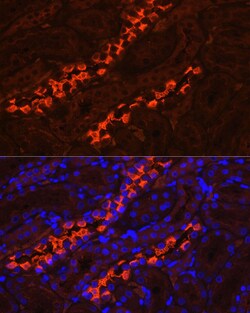 Invitrogen ATP6V1B1 Polyclonal Antibody 100 &mu;L; Unconjugated:Antibodies,