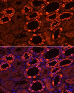 Invitrogen ATP6V1B1 Polyclonal Antibody 100 &mu;L; Unconjugated:Antibodies,