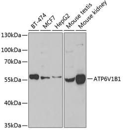 Invitrogen ATP6V1B1 Polyclonal Antibody 100 &mu;L; Unconjugated:Antibodies,