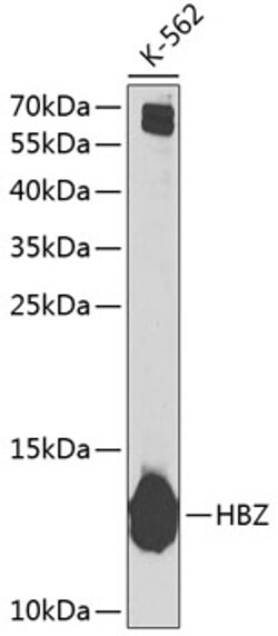 Invitrogen HBZ Polyclonal Antibody 100 &mu;L; Unconjugated:Antibodies,