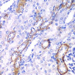 MYO1C Polyclonal Antibody, Invitrogen 100 &mu;L; Unconjugated:Antibodies,