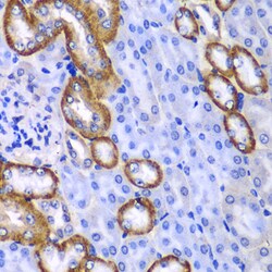 MYO1C Polyclonal Antibody, Invitrogen 100 &mu;L; Unconjugated:Antibodies,