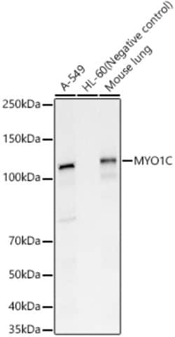 MYO1C Polyclonal Antibody, Invitrogen 100 &mu;L; Unconjugated:Antibodies,