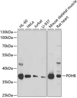Invitrogen PDHB Polyclonal Antibody 100 &mu;L; Unconjugated:Antibodies,
