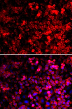 Invitrogen QARS Polyclonal Antibody 100 &mu;L; Unconjugated:Antibodies,